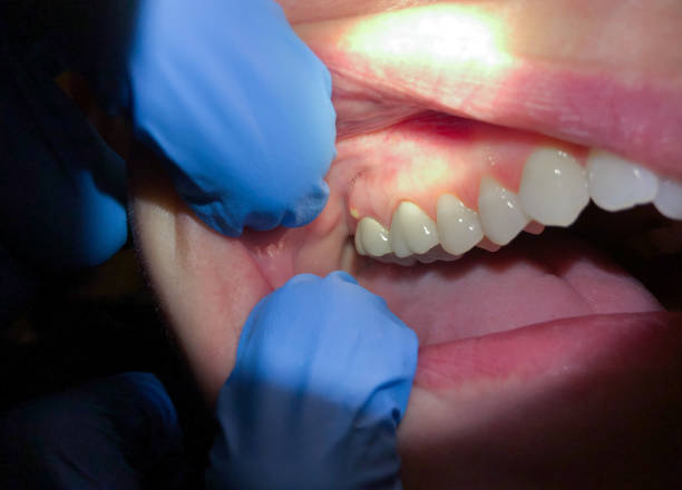 Best Tooth Pain Emergency Relief  in Salineville, OH