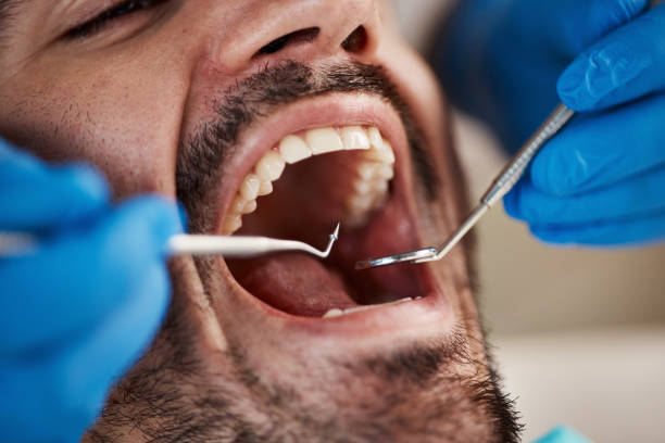 Best Root Canal Emergency Dentist  in Salineville, OH
